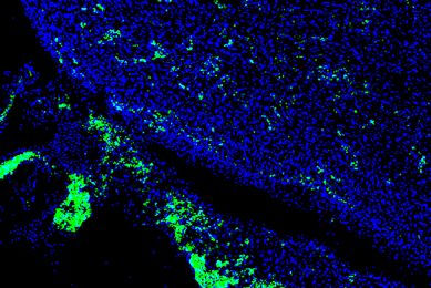 Human iPS cells (green) contributed to a developing heart of 4-week-old pig embryo. Photo: Salk Institute}