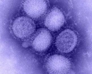 H1N1 found in several Manitoba herds